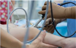 Elbow Arthroscopic doctor