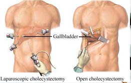 Elbow Arthroscopic doctor