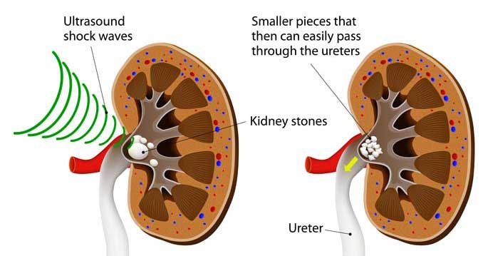 Dysmenorrhea Doctors